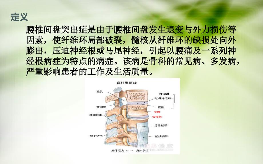 腰椎间盘突出症的护理_第1页