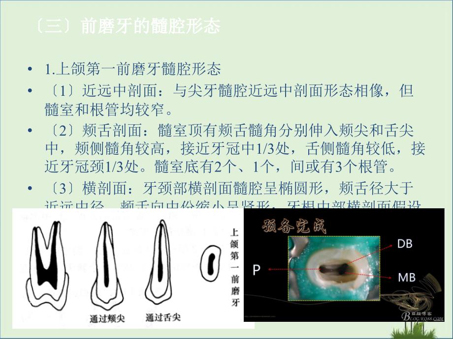 前磨牙及磨牙髓腔解剖_第1页