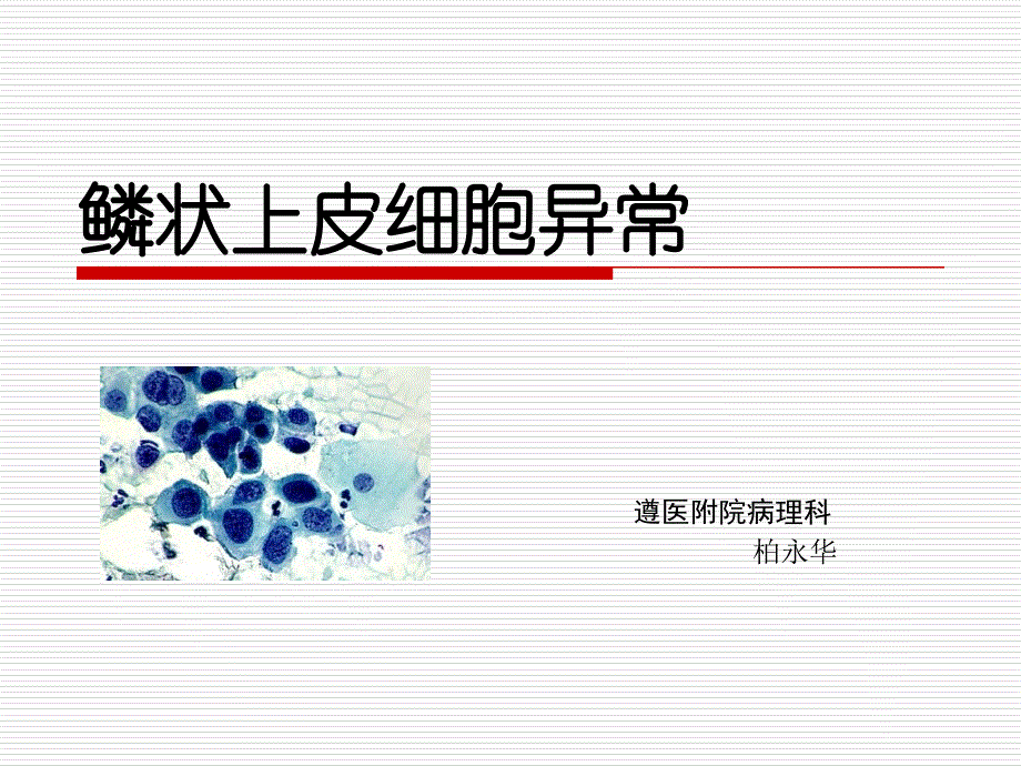 鳞状上皮细胞异常_第1页