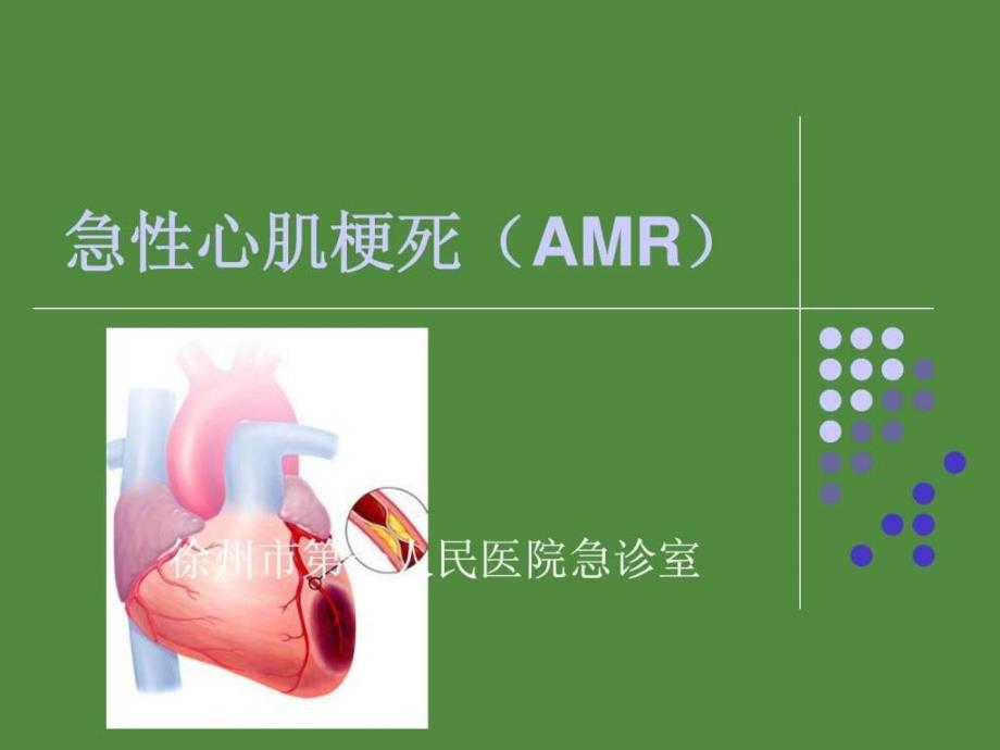 急性心肌梗死护理查房_第1页