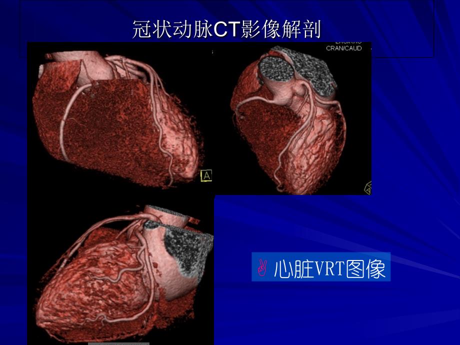 雙源CT及其臨床應(yīng)用qPPT_第1頁(yè)