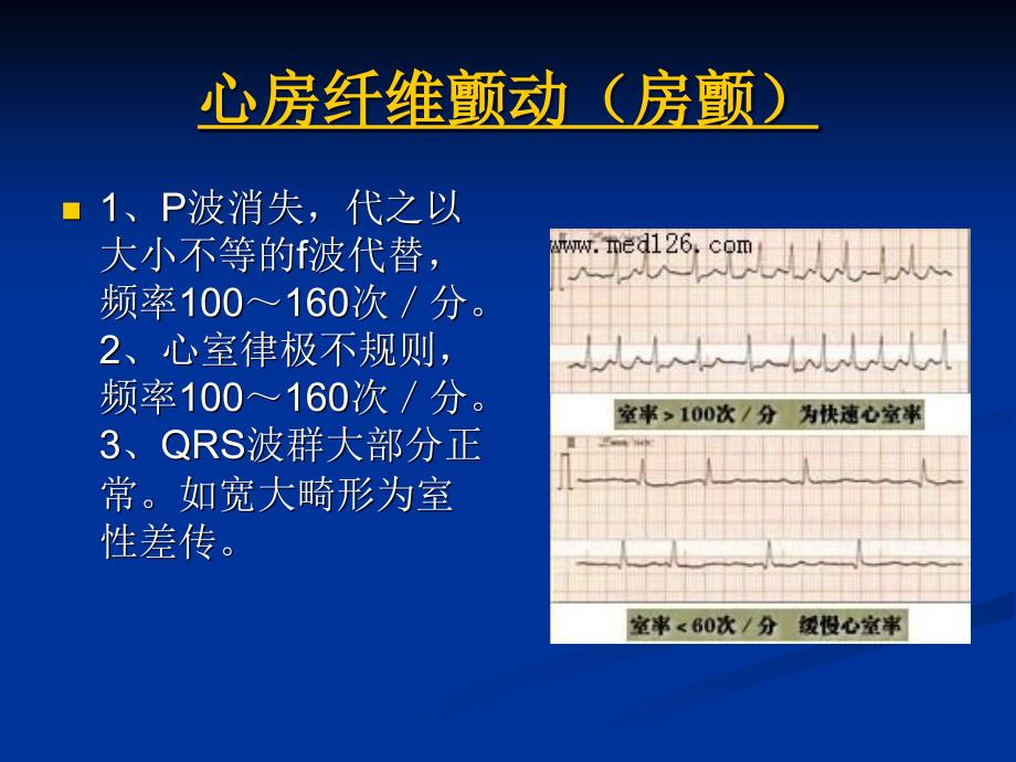 心房纤维颤动房颤_第1页