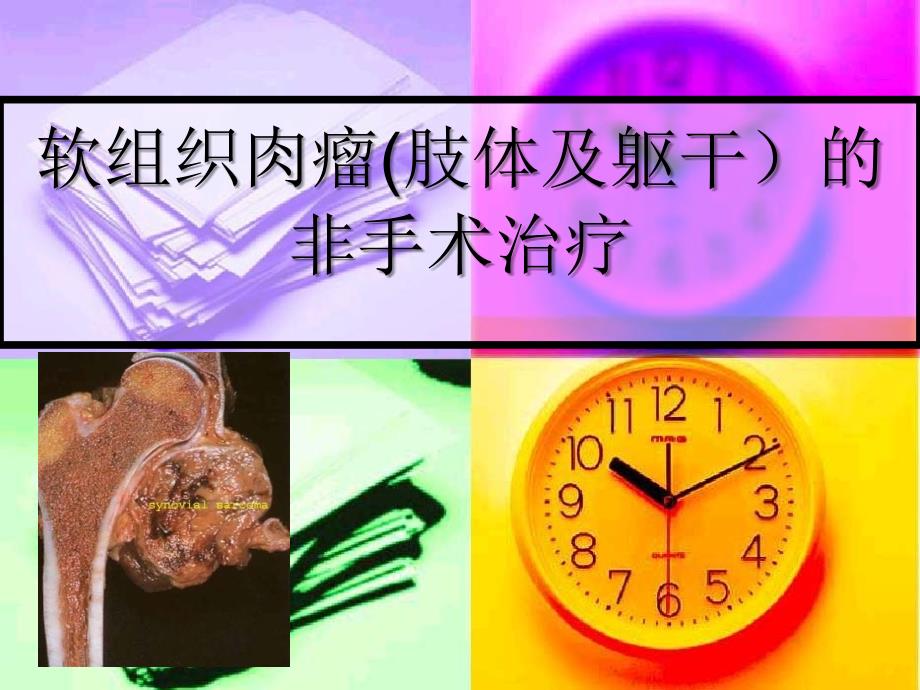 软组织肉瘤的非手术治疗_第1页