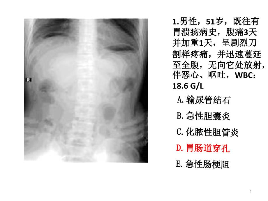 住院醫(yī)師規(guī)陪出科考試輔助檢查_第1頁(yè)