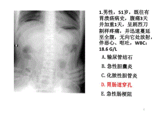 住院醫(yī)師規(guī)陪出科考試輔助檢查