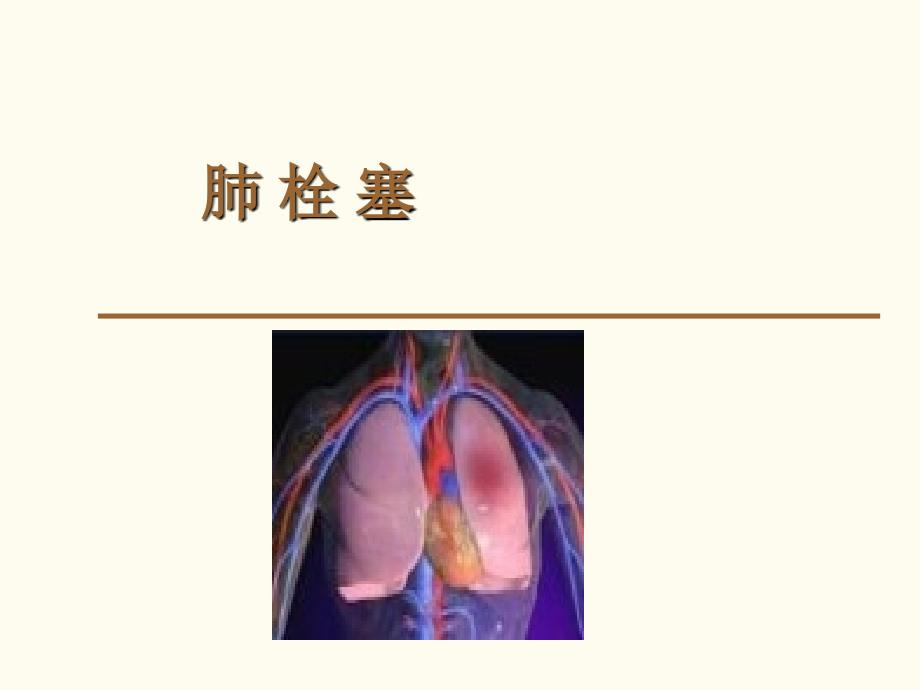 肺栓塞影像表现_第1页