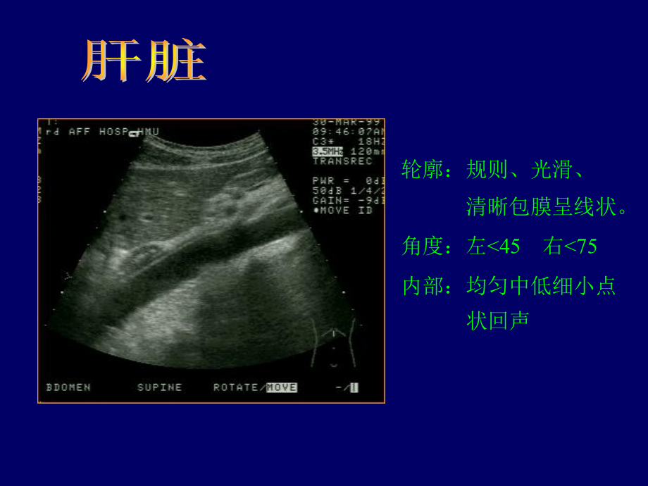 B超影像图谱-课件_第1页