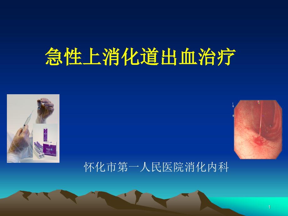 上消化道出血的诊断及治疗研究进展课件_第1页