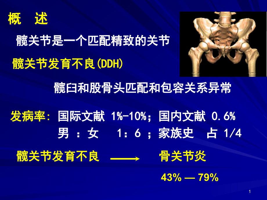 医学ppt课件成人髋关节发育不良的手术选择_第1页