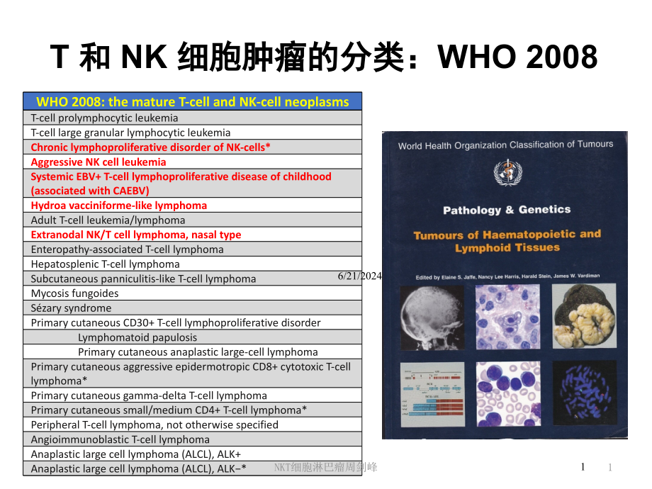 NKT细胞淋巴瘤课件_第1页