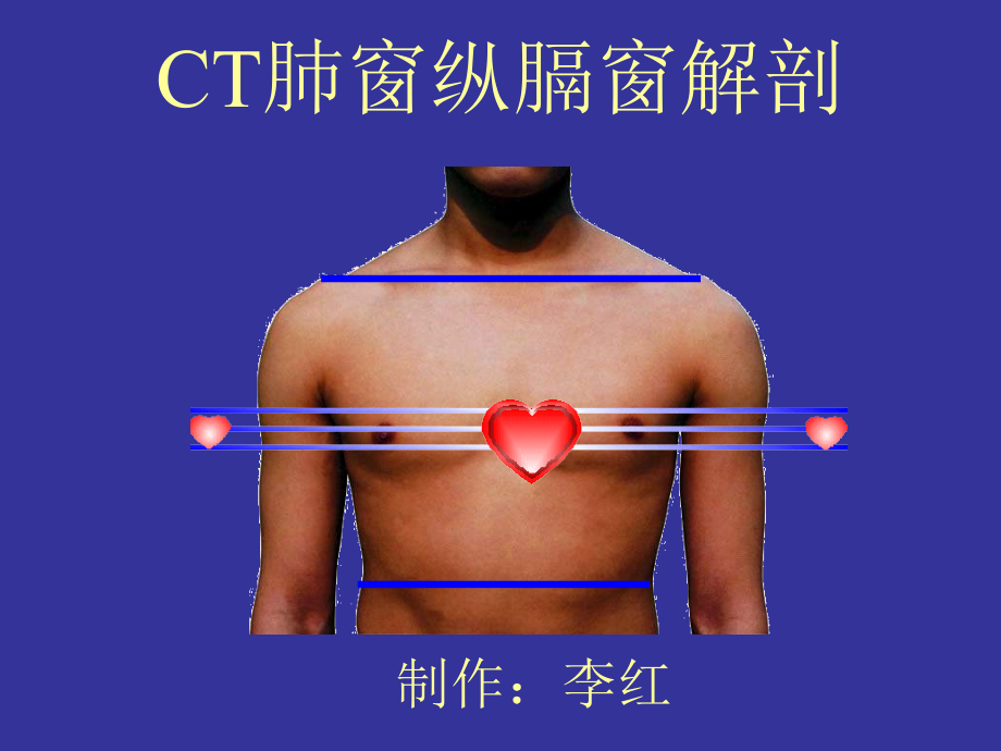 CT肺窗横断层解剖(行业运用)课件_第1页