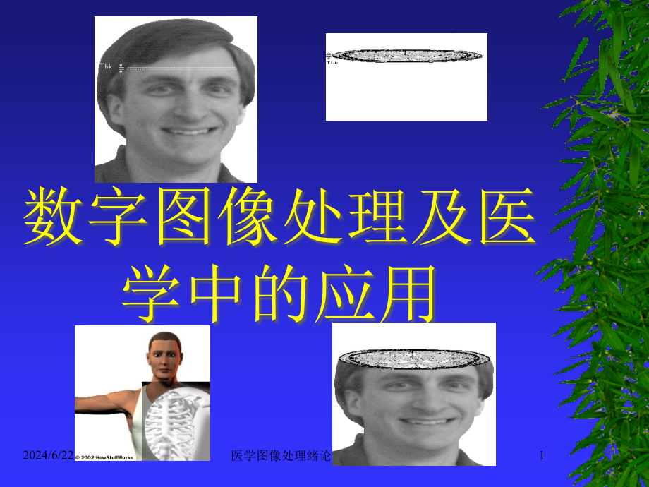 医学图像处理绪论ppt课件_第1页