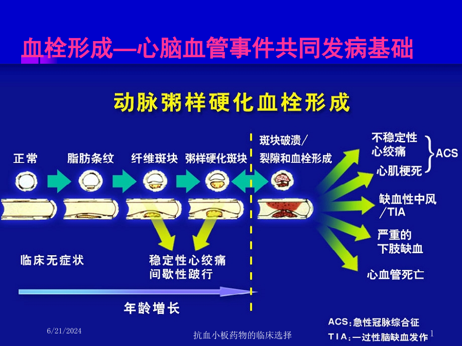 抗血小板药物的临床选择培训课件_第1页