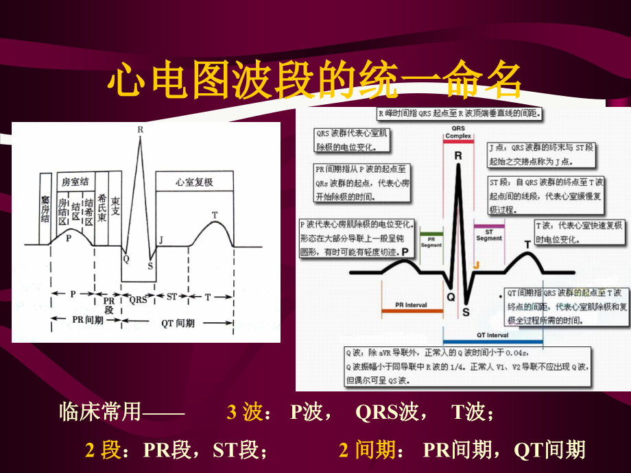 心电图心电向量与心肌缺血课件_第1页