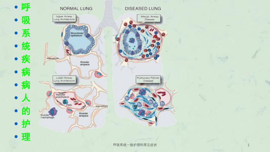 呼吸系统一般护理和常见症状ppt课件_第1页