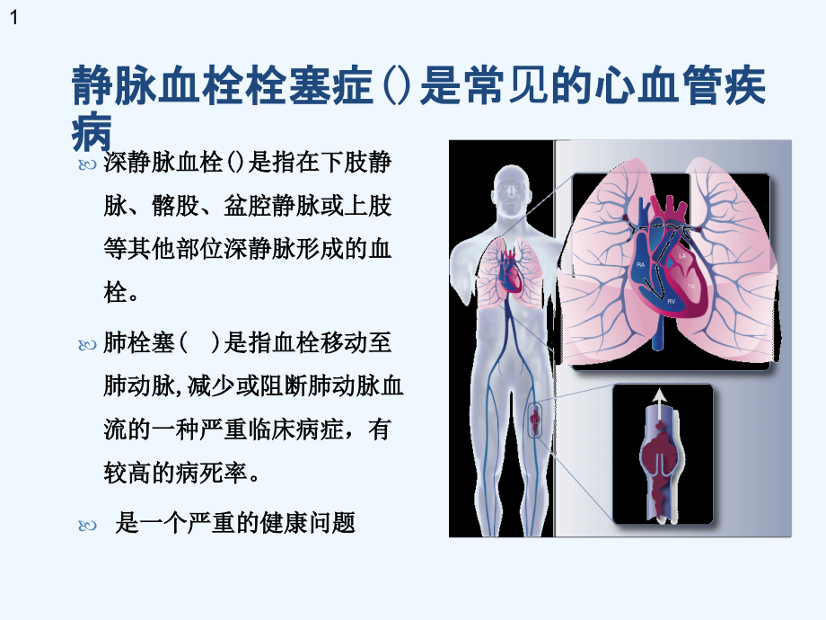 DVT的介入治疗经颈静脉逆行入路课件_第1页