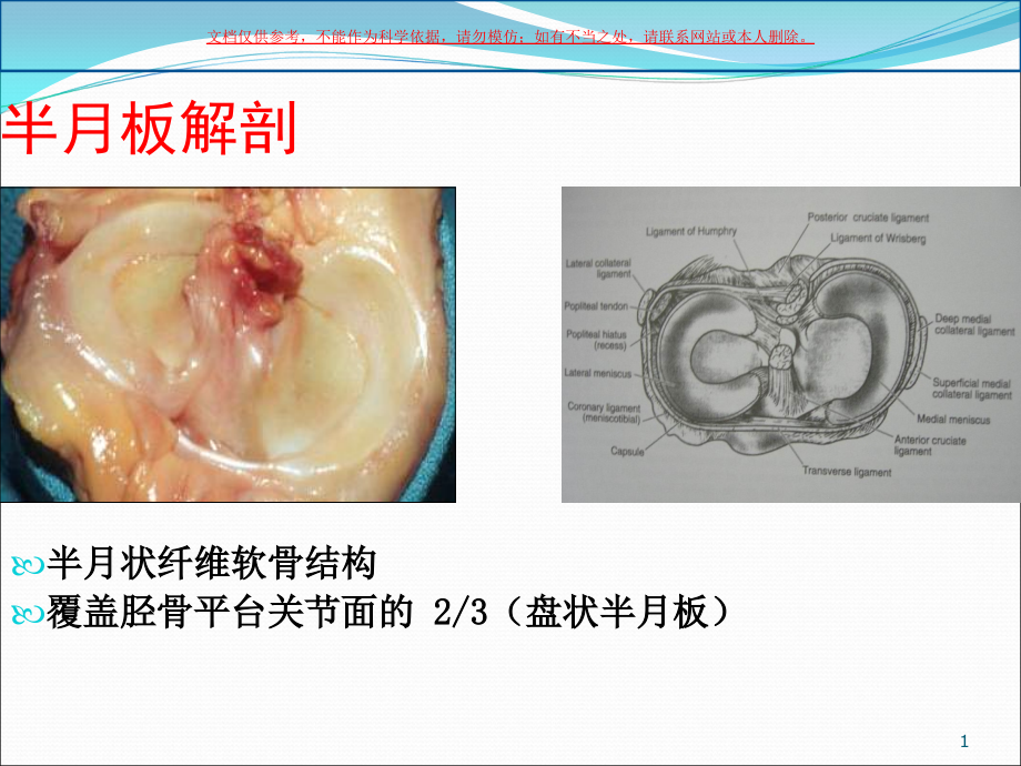 半月板损伤专业医学知识宣讲ppt课件_第1页