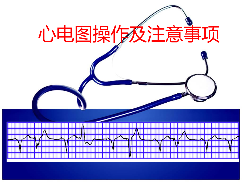 心电图检查操作及注意事项课件_第1页