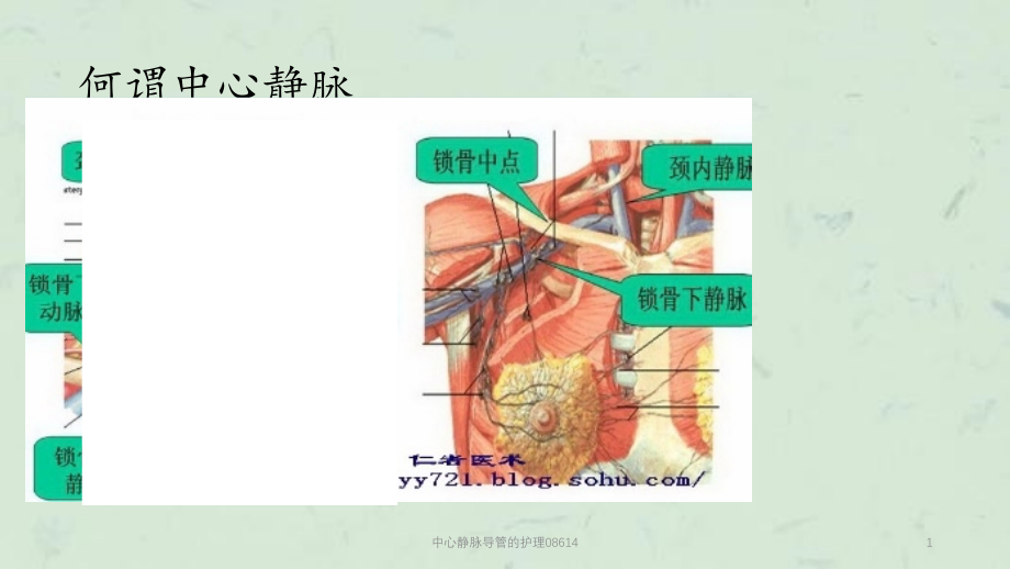 中心静脉导管的护理 课件_第1页