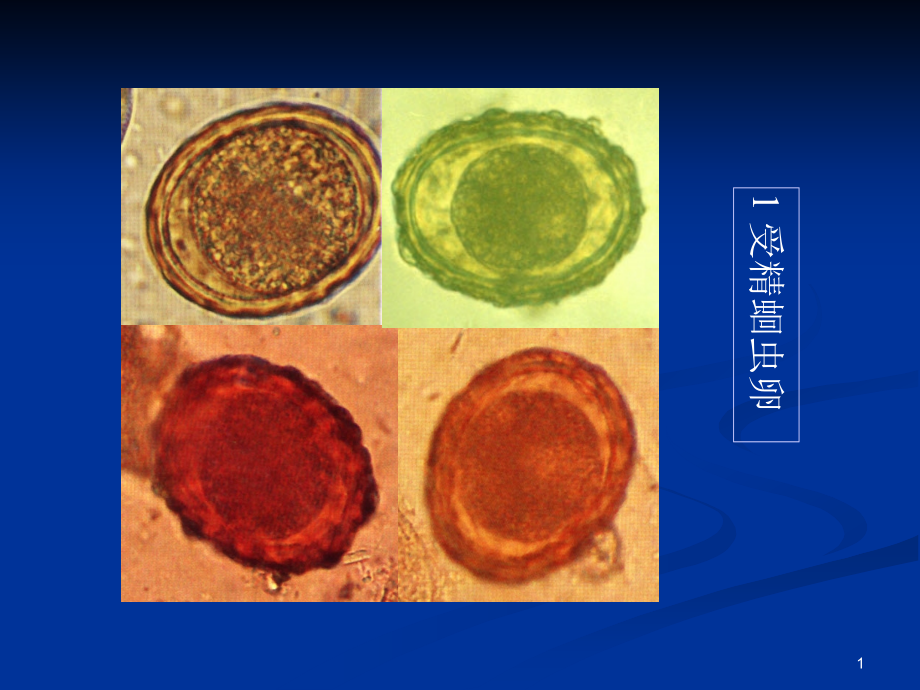 人体寄生虫学标本复习课件_第1页