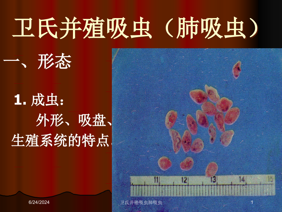 卫氏并殖吸虫肺吸虫培训ppt课件_第1页