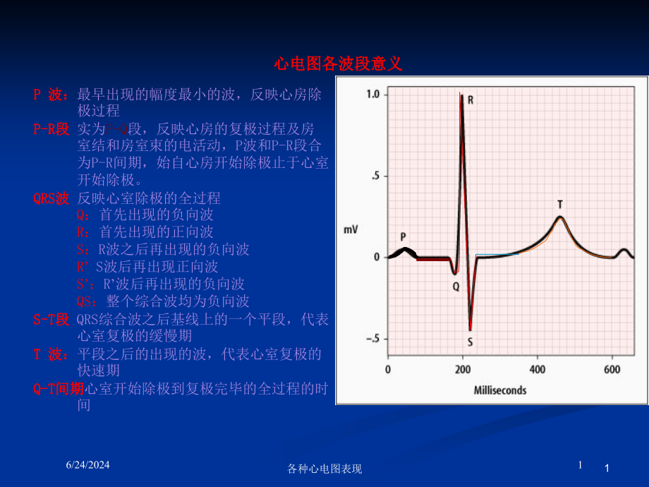 各种心电图表现ppt课件_第1页