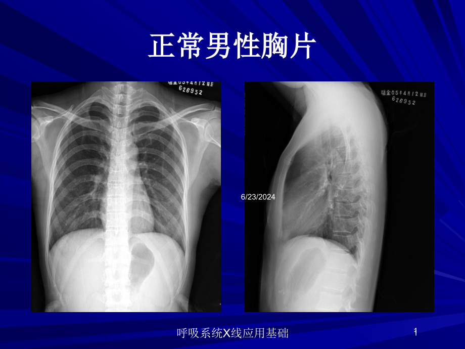 呼吸系统X线应用基础培训ppt课件_第1页