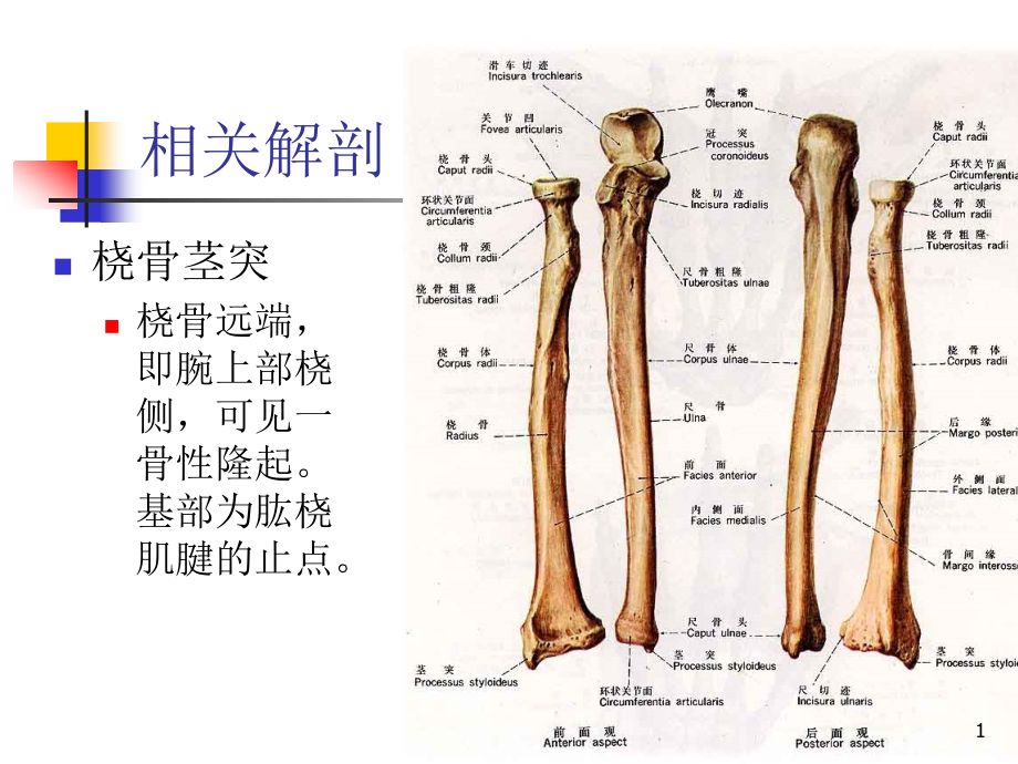 医学ppt课件桡骨茎突部狭窄性腱鞘炎_第1页