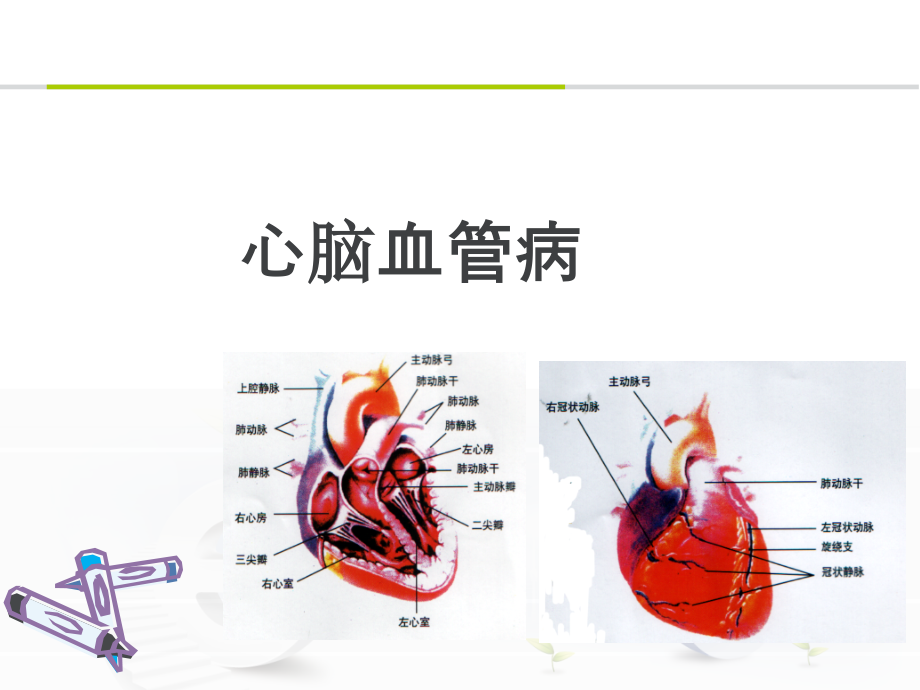 心脑血管病课件_第1页