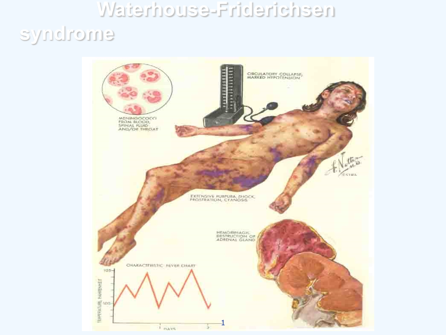 病理生理学凝血和抗凝血平衡紊乱课件_第1页