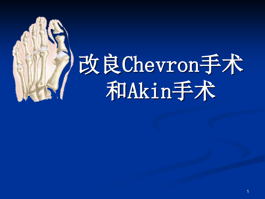 改良CHEVRON手术和AKIN手术学习课件_第1页