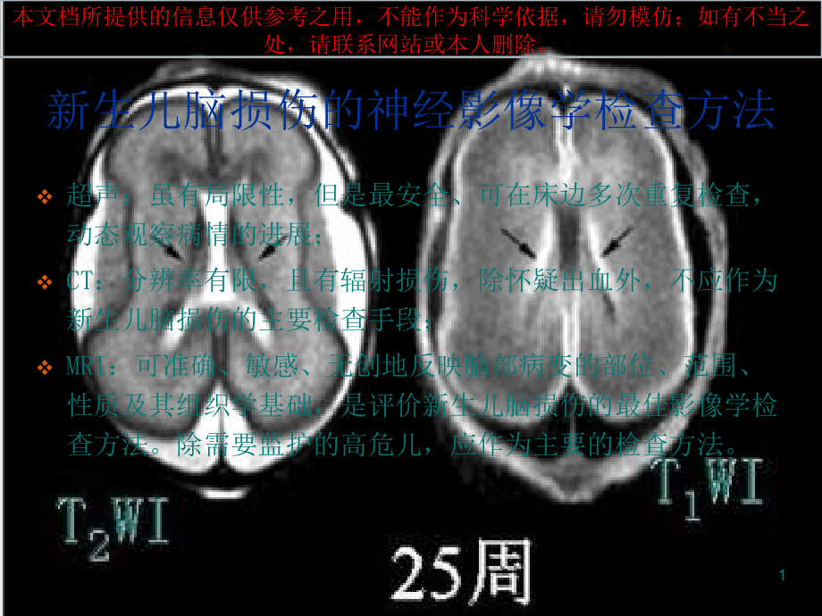 新生儿缺氧缺血或窒息所致脑损伤的影像学诊疗培训ppt课件_第1页