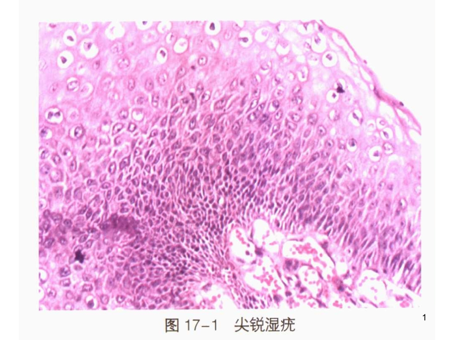 皮肤疾病彩色病理图谱课件_第1页