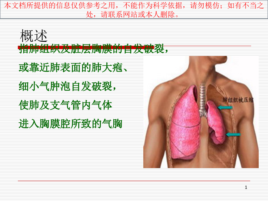 液气胸病人医疗护理查房培训ppt课件_第1页