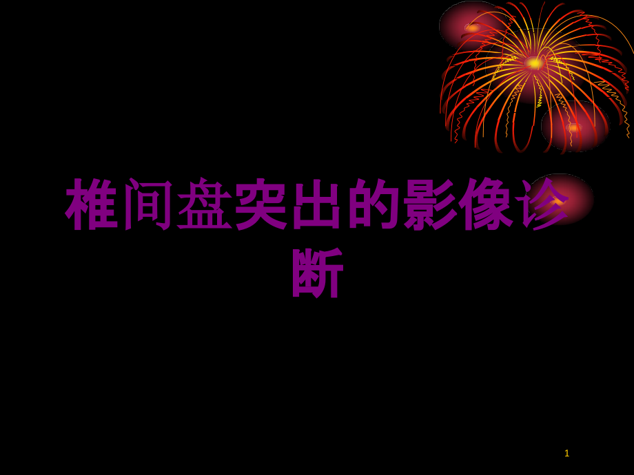 椎间盘突出的影像诊断培训ppt课件_第1页