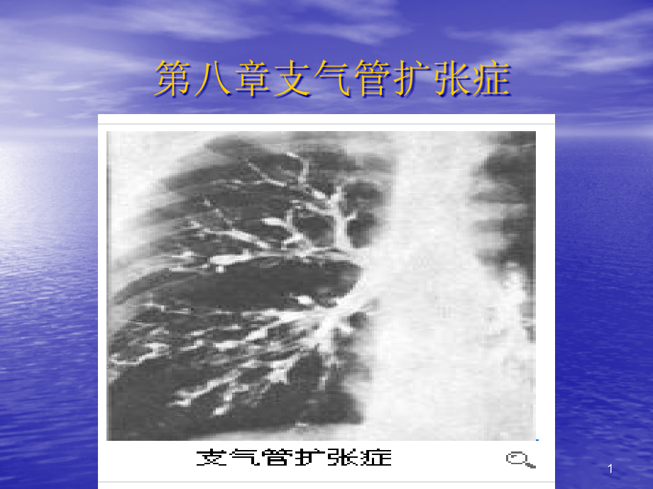 第八章支气管扩张症课件_第1页