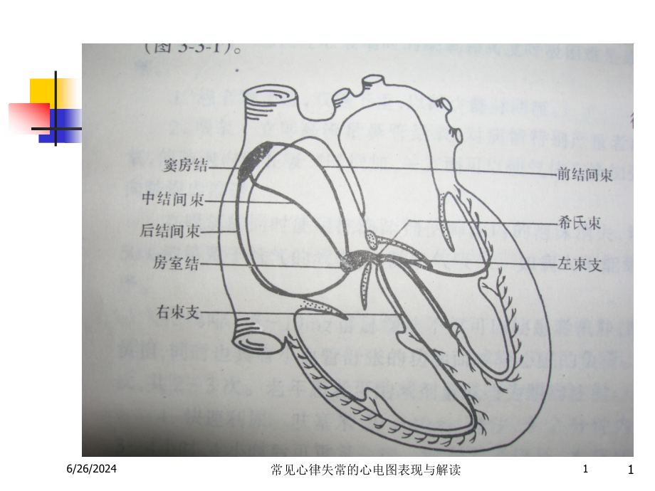 常见心律失常的心电图表现与解读培训ppt课件_第1页