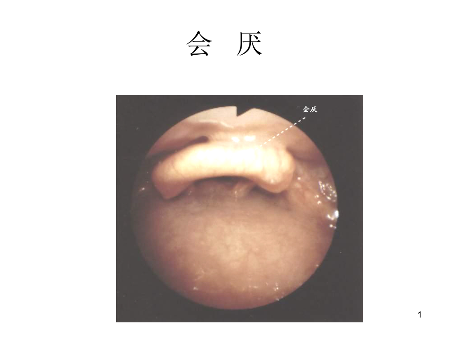 支气管镜精美图谱课件_第1页