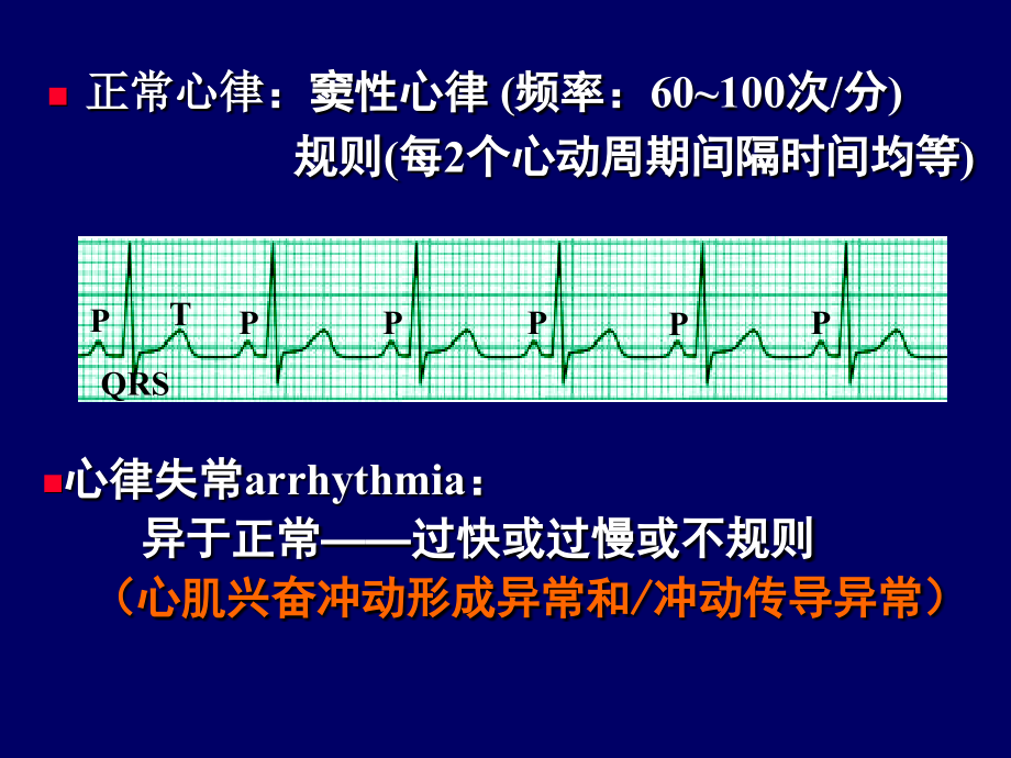 抗心律失常药ppt课件_第1页