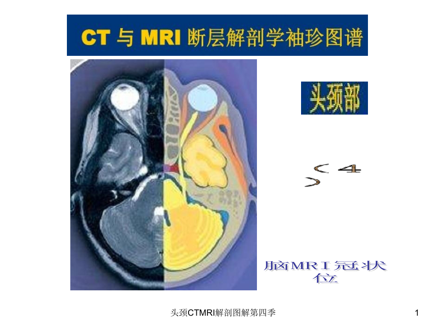 头颈CTMRI解剖图解第四季ppt课件_第1页