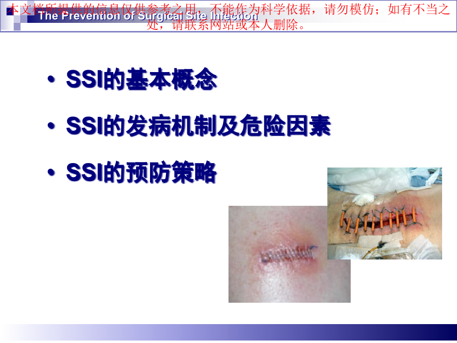 手术部位感染预防和控制培训ppt课件_第1页