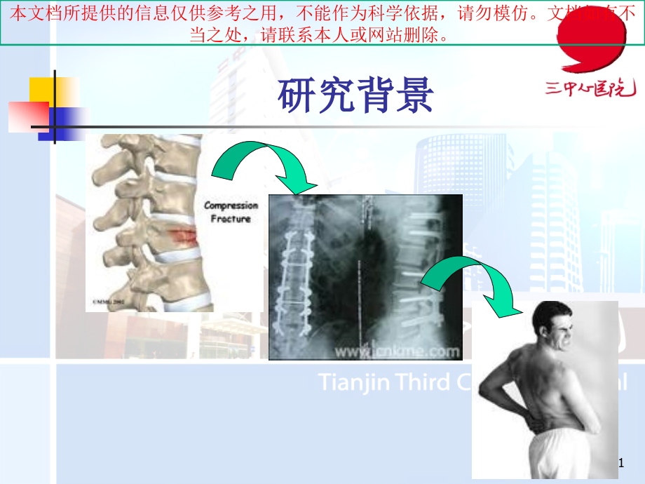 经皮椎弓根螺钉内固定术治疗胸腰椎骨折固定培训ppt课件_第1页