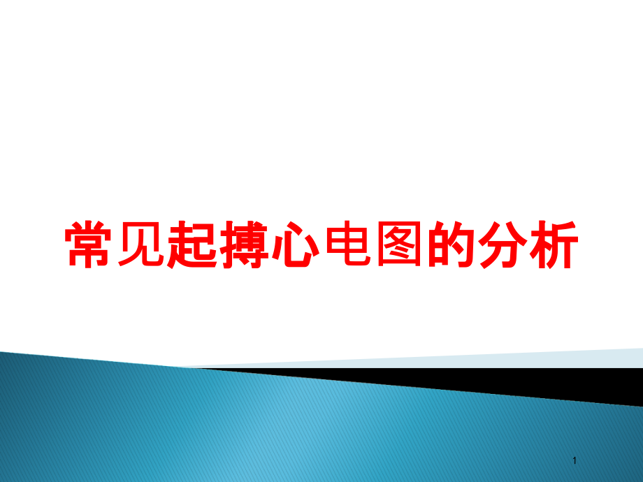 常见起搏心电图的分析培训ppt课件_第1页