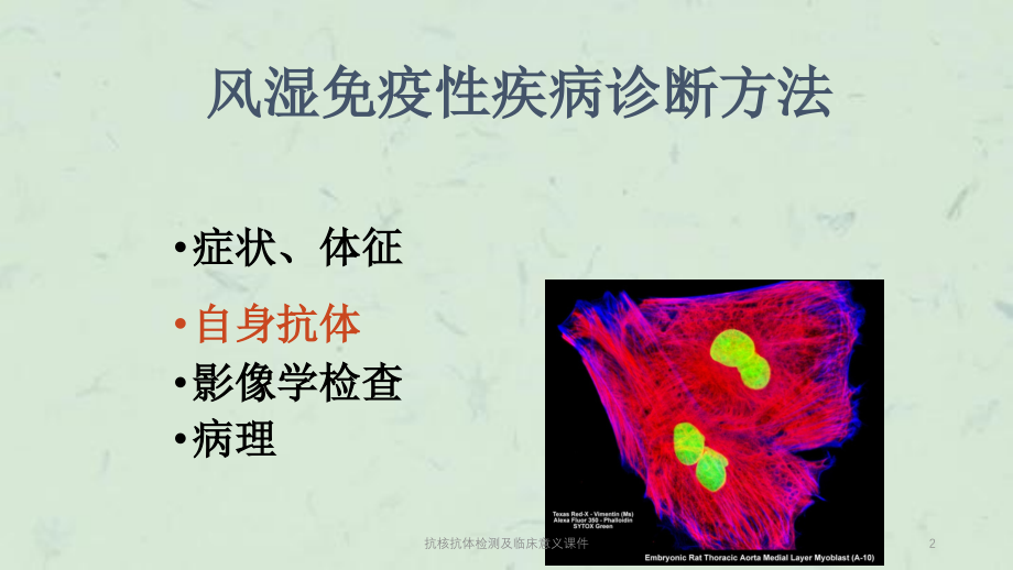 抗核抗体检测及临床意义ppt课件_第1页