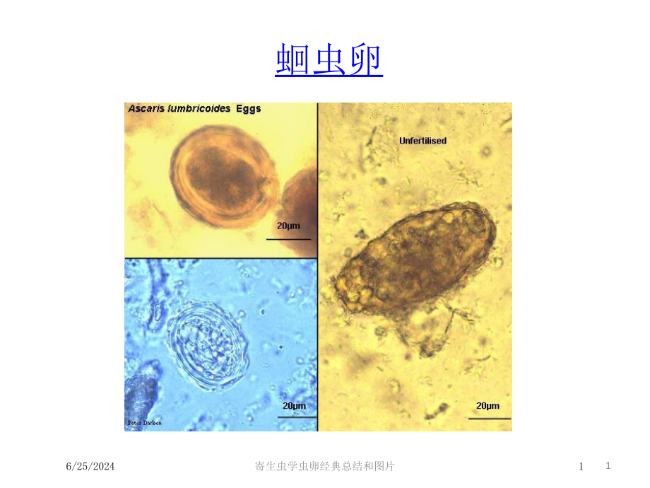 寄生虫学虫卵经典总结和图片ppt课件_第1页