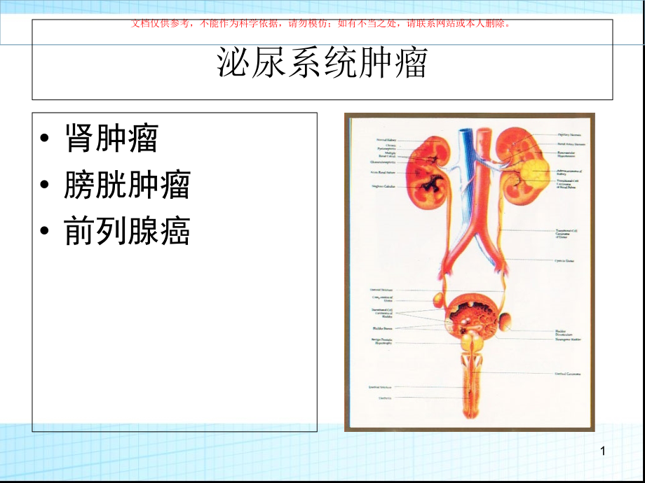 泌尿系统肿瘤ppt课件_第1页