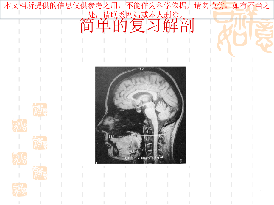 延髓背外侧综合征宣讲培训ppt课件_第1页