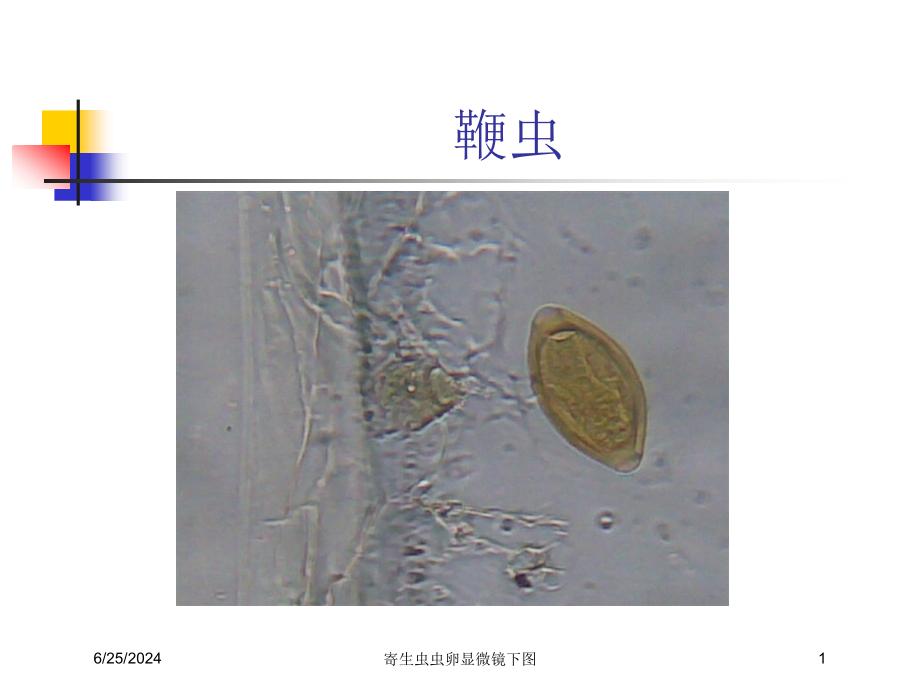 寄生虫虫卵显微镜下图ppt课件_第1页