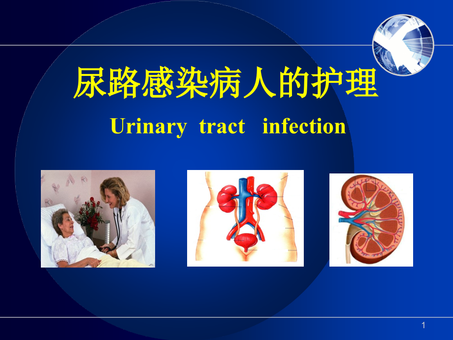 尿路感染护理非常全面研究演示课件_第1页