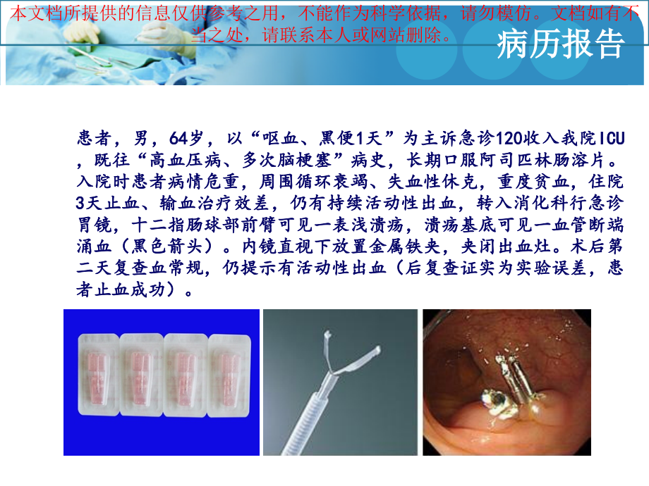 消化道出血医患沟通培训ppt课件_第1页